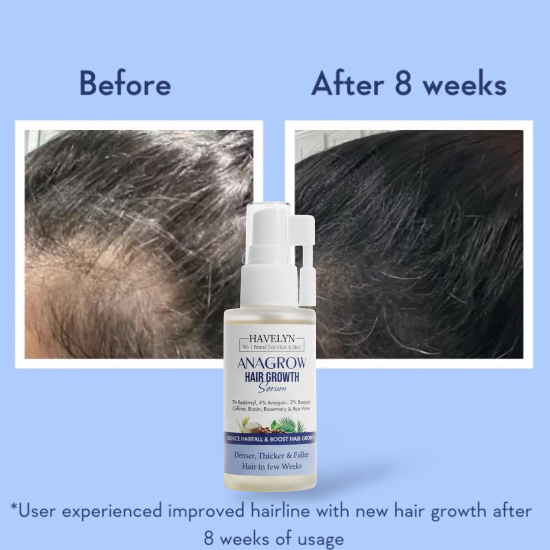 Anagrow Hair Growth Serum
